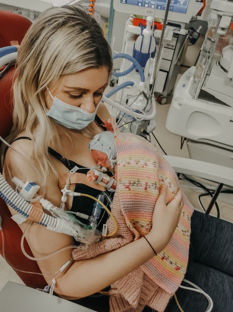 Other image for Toddler Elsie is mum’s ‘little miracle’